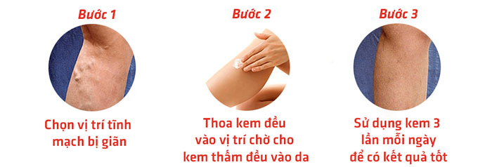 Kem Varikosette Hỗ Trợ Điều Trị Suy Giãn Tĩnh Mạch Chăm Sóc Da-1
