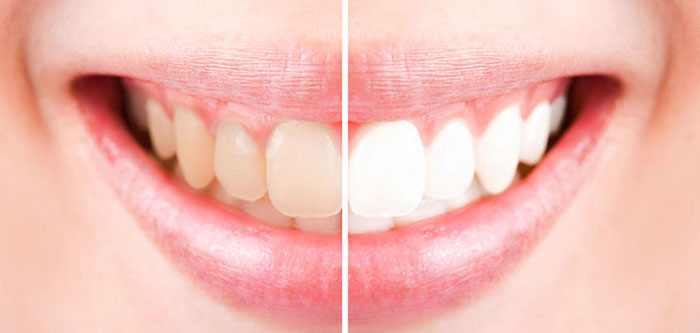 Kem Đánh Răng Trắng Sáng Hương Trà Xanh Darlie Thái Lan Chính Hãng Chăm Sóc Cá Nhân-1