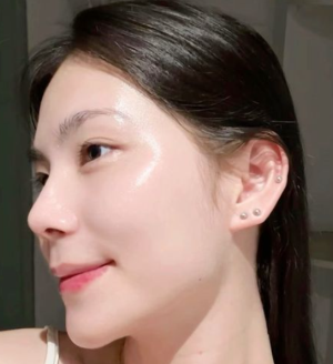 Kem Dưỡng Da Trị Nám Collagen Luxury Gold Cream Hàn Quốc - Bí Quyết Làn Da Trắng Sáng, Mờ Nám