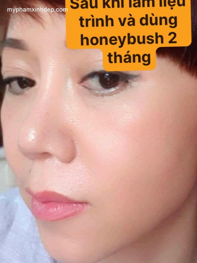 Viên Uống Chống Nắng HoneyBush Skin Solution Chăm Sóc Da-1