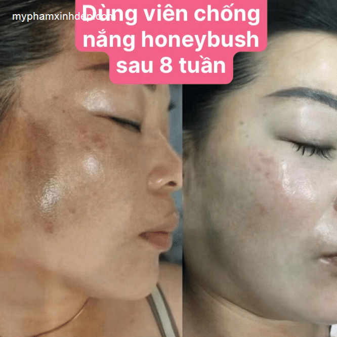 Viên Uống Chống Nắng HoneyBush Skin Solution-3